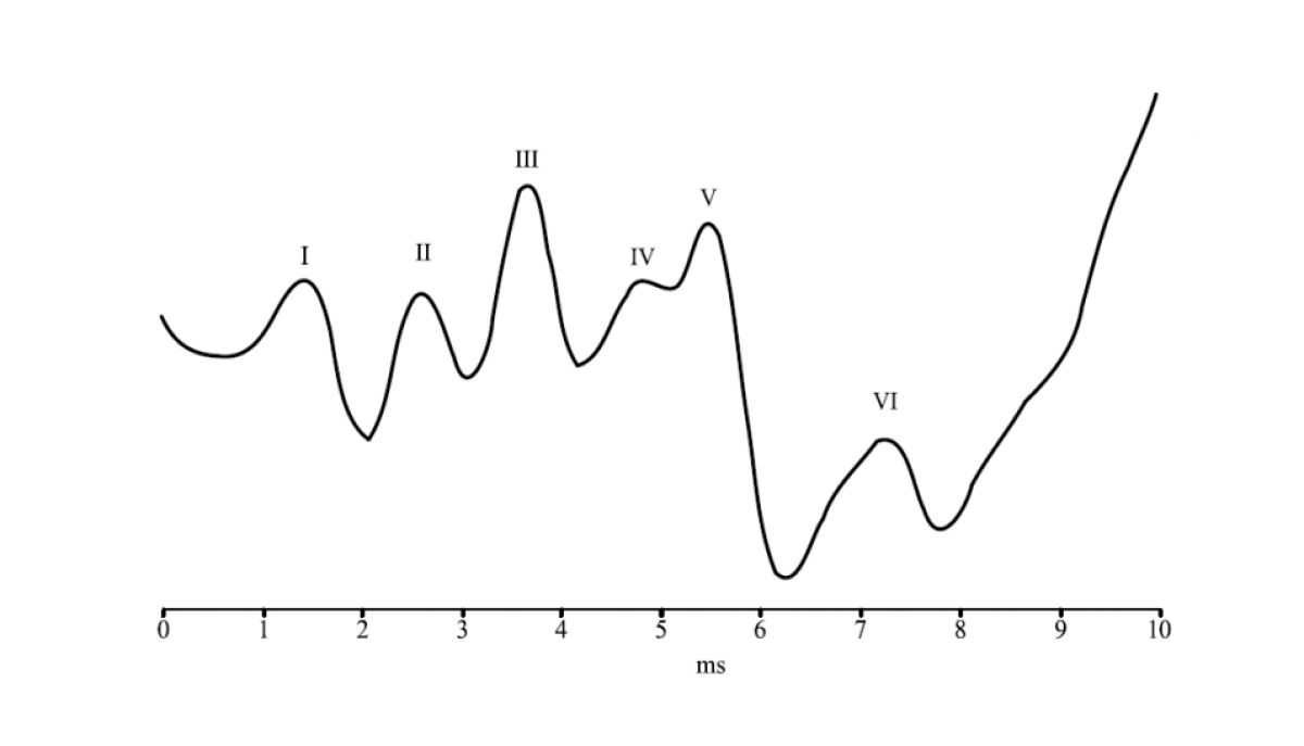 Abr org. Abr-тест. Abr (answer bid ratio).