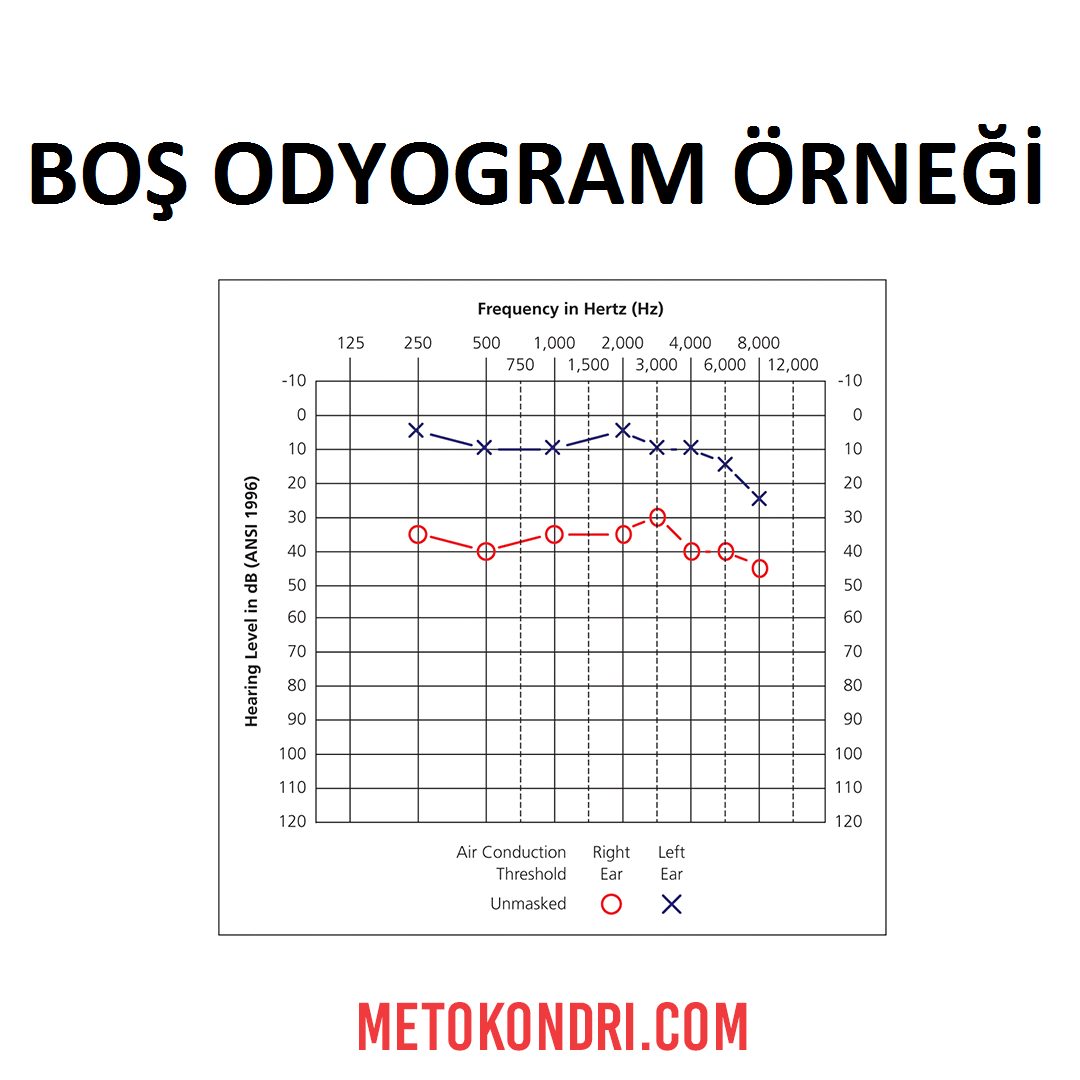 Boş Odyogram Örneği